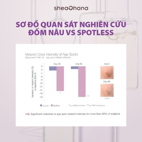 SPOT OUT BEAUTY OIL – Dầu dưỡng mờ thâm nám làm đều màu da