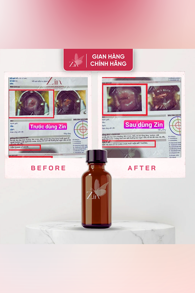 Tinh Dầu Khử Mùi, Giảm Sưng Ngứa Zin