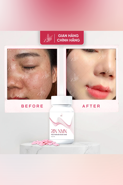 Viên Uống Nội Tiết Trắng Da Mờ Nám Zin NMN