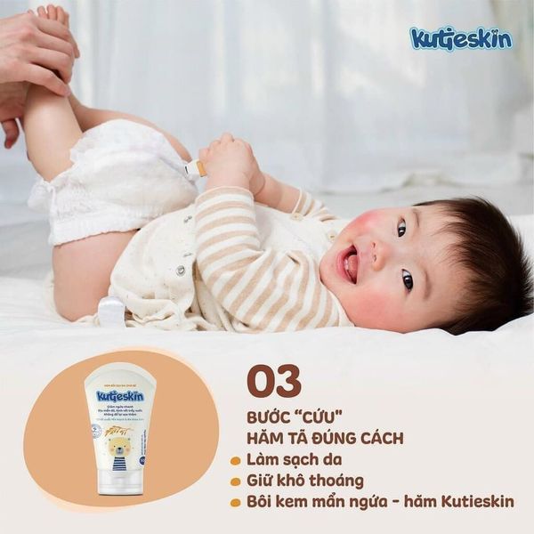 Kem KUTIESKIN, Chăm Sóc Làn Da Cho Mẹ và Bé, Dưỡng Ẩm, Chống Khô Nẻ - 30Gram