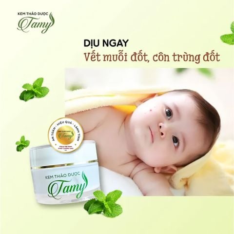 [Chính Hãng] Kem Da Thảo Dược Bôi Da Tamy Dùng Cho Mọi Lứa Tuổi Viêm Da Cơ Địa