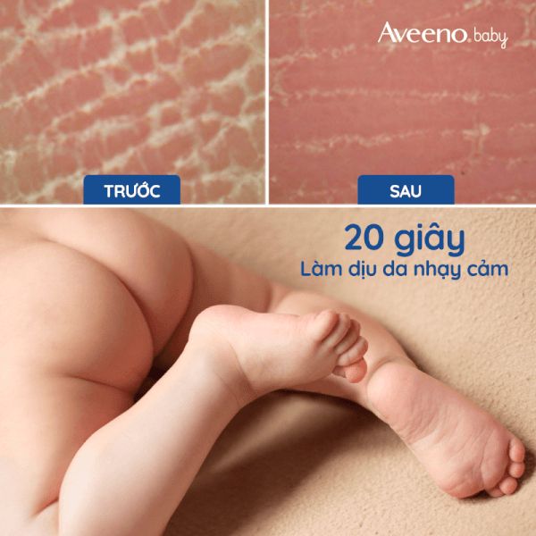 Kem Dưỡng Da Cho Bé AVEENO BABY Cho Bé Từ Sơ Sinh