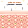 Lăn Bôi Muỗi Và Côn Trùng Cắn Chicco 10ML Xua Đuổi Côn Trùng