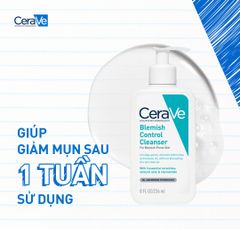 Sữa Rửa Mặt Cerave Blemish Control Cleanser Cho Da Dầu Mụn