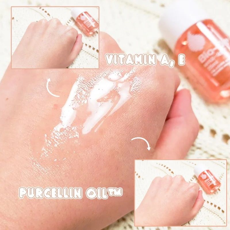 Tinh dầu Bio Oil ngừa rạn da, làm giảm mờ sẹo