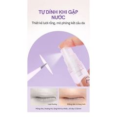 Bộ dụng cụ kích mí lưới Mlen Diary