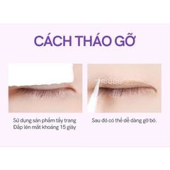 Bộ dụng cụ kích mí lưới Mlen Diary