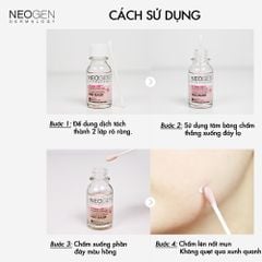 Chấm Mụn 2 Lớp Xẹp Mụn Sau 4H Neogen Dermalogy A-Clear Aid Soothing Pink Eraser 15ml