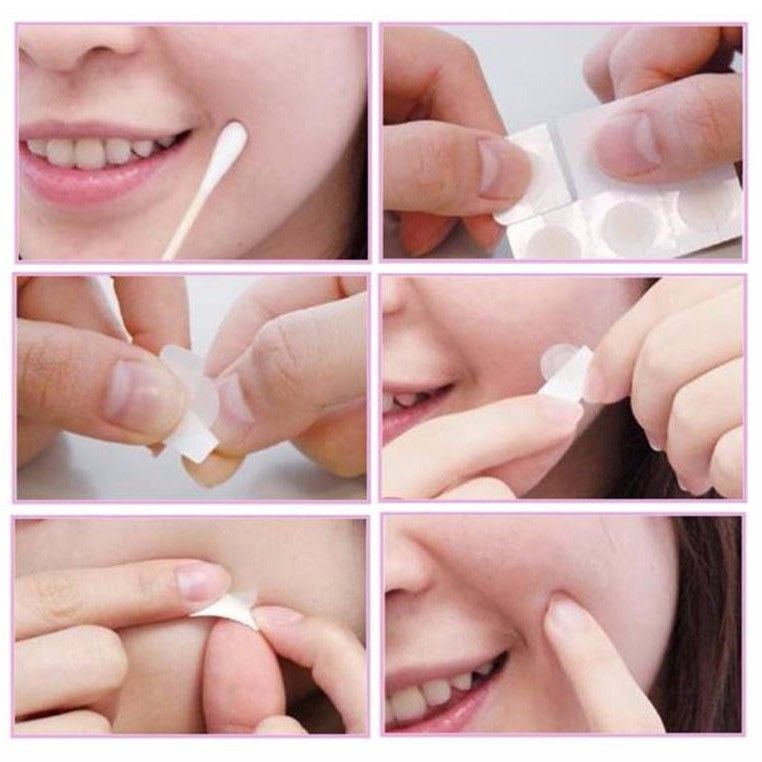 Miếng dán mụn Mayan care