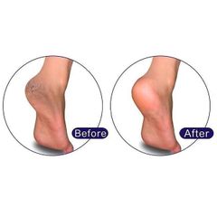 Chà gót chân Vacosi