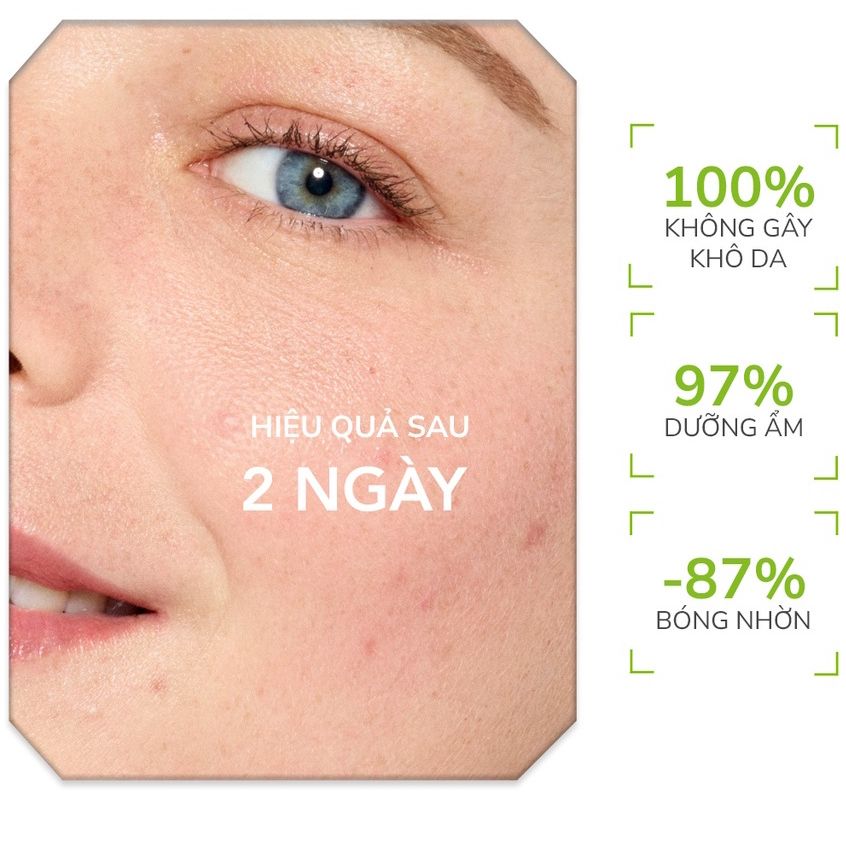 Kem Dưỡng Giảm Mụn Bioderma Sebium Kerato+ Cream 30ml