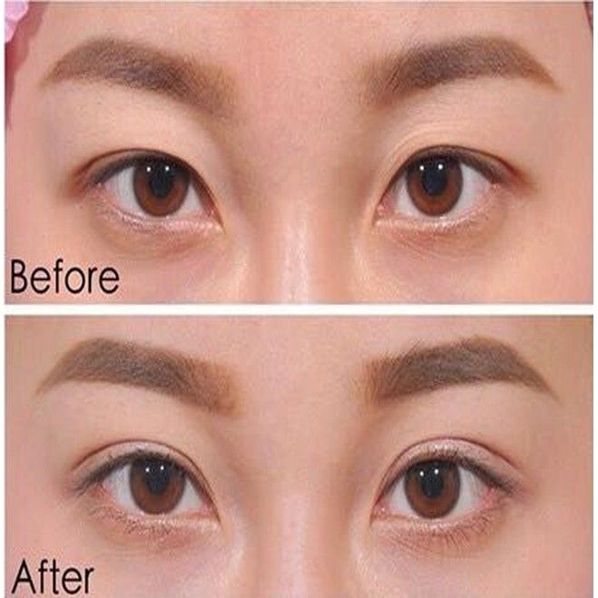 Miếng Dán Kích Mí Vacosi Eyelid Tape 500 miếng Size S