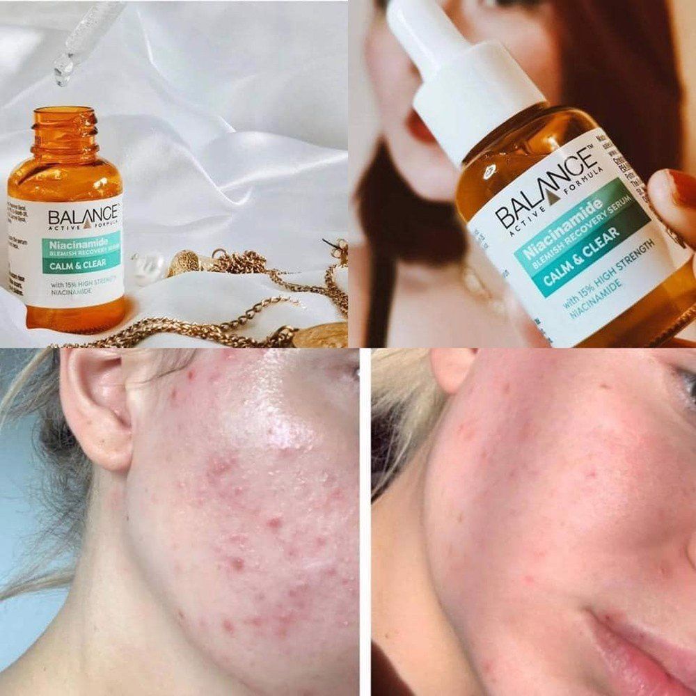 Tinh chất giảm mụn mờ thâm Balance Active Formula Niacinamide 15% Blemish Recovery Serum 30ML