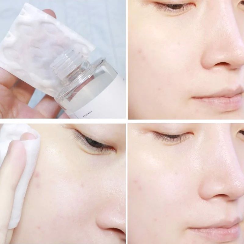 Nước Hoa Hồng The Lab Oligo Hyaluronic Acid 5000 Da 200ml