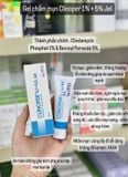  (BPO + Clin) Gel chấm mụn Clinoper 1% + 5% Benzoy Jel 25g 