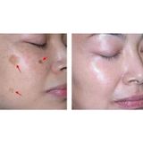  Meline 02 Caucasian Skin Night-Huyết Thanh Đặc Trị Nám 20g 