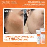  [Hàng công ty] Kem giảm nám tàn nhang sáng da Tranacix cream 30g 