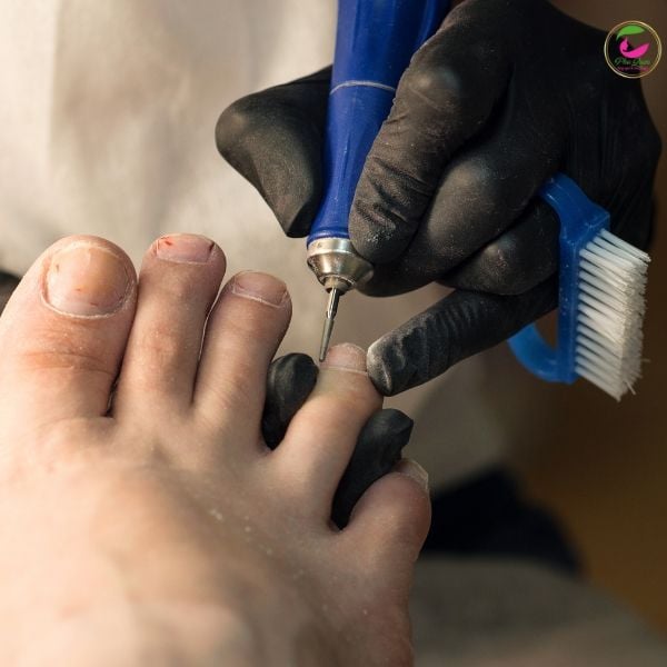 Tẩy gel móng chân