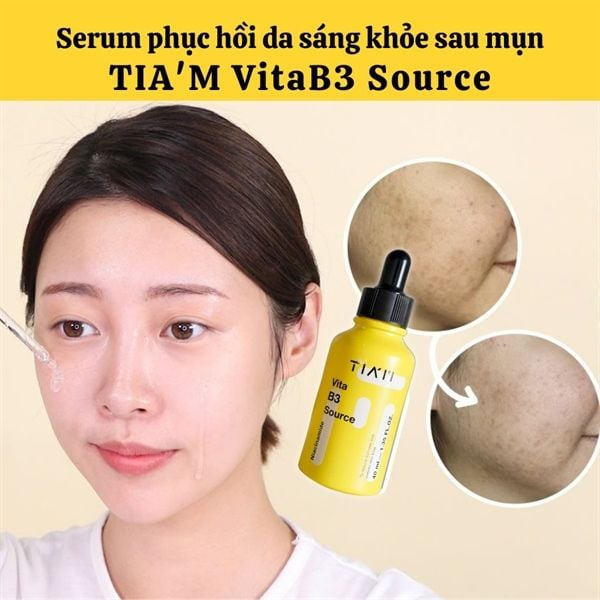 Serum Tia'm Làm Sáng, Phục Hồi Cho Da Dầu Mụn, Nhạy Cảm 40ml Vita B3 Source (10% Niacinamide + 2% Arbutin)