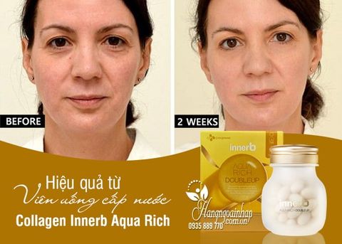 Viên Uống Cấp Nước InnerB Aqua Rich Doubleup 70 PCS