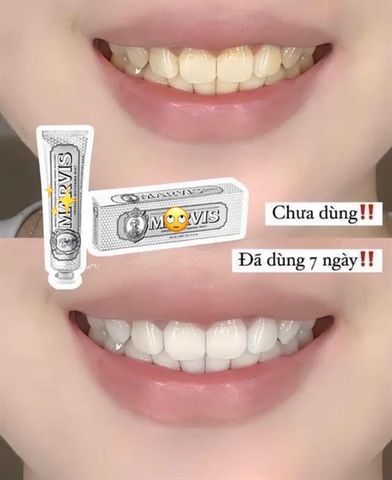 (CÔNG TY) Kem Đánh Răng Marvis Màu Bạc Làm Trắng Răng 85ml