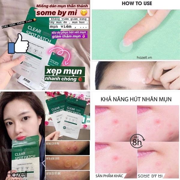 Miếng Dán Mụn Some By Mi 30 Days Miracle Clear Spot Patch (18 pcs)