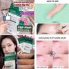Miếng Dán Mụn Some By Mi 30 Days Miracle Clear Spot Patch (18 pcs)