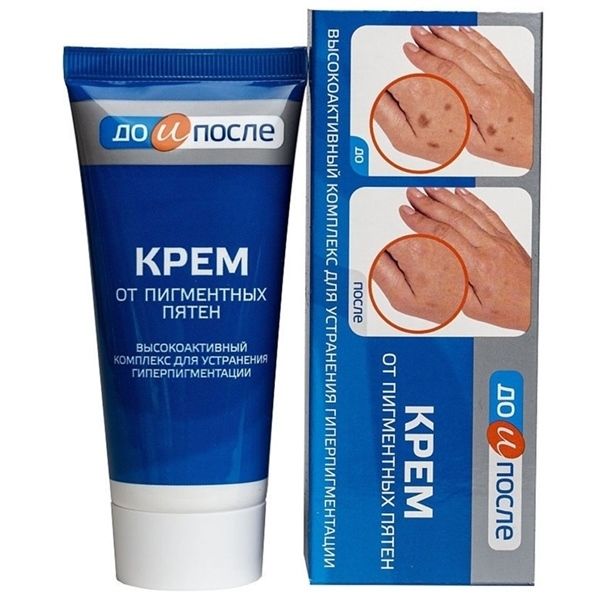 Kem Trị Đồi Mồi Đốm Nâu Da Tay Kpem Từ Nga 50ml