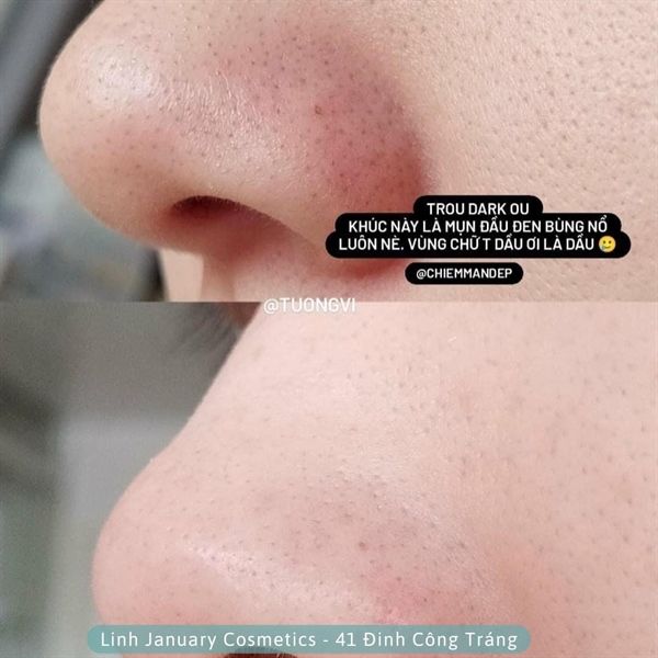 Mặt Nạ Đất Sét Thu Nhỏ Lỗ Chân Lông, Điều Tiết Dầu Thừa Aperire Spa Relief BE FROZEN Pore Mask 120g