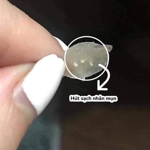 Miếng Dán Mụn Cosrx 24 Miếng Acne Pimple Master Patch