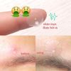 Miếng Dán Mụn Some By Mi 30 Days Miracle Clear Spot Patch (18 pcs)