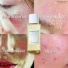 Nước Hoa Hồng Rau Má Skin1004 Madagascar Centella Asiatica Toning 210ml