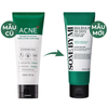 Sữa Rửa Mặt Some By Mi Làm Sạch Sâu Cho Da Dầu Mụn 100ml 30 Days Miracle Acne Clear Foam 100ml
