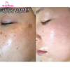 Kem Dưỡng Hỗ Trợ Giảm Nám Tàn Nhang MelasmaX 3D Whitening Clinic Renewal 40ml