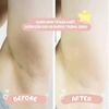 Kem thâm nách Alpha Arbutin 3 plus Organic Underarm By Perfect Skincare