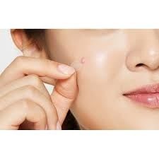 Miếng Dán Mụn Cosrx Che Mụn Hiệu Quả, Siêu Mỏng 18 Miếng Clear Fit Master Patch