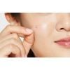 Miếng Dán Mụn Cosrx Che Mụn Hiệu Quả, Siêu Mỏng 18 Miếng Clear Fit Master Patch