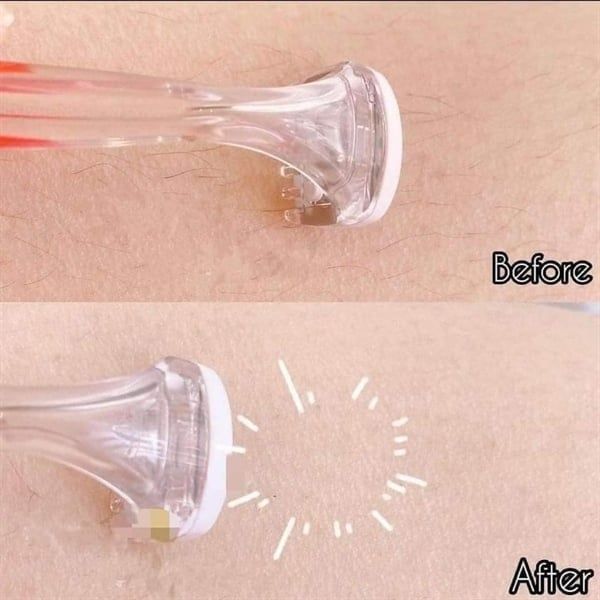 Dao Cạo Kai Vùng Bikini (Set 2 Cái)