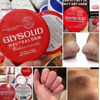 Kem nẻ Glysolid Hautbalsam chống da khô nứt nẻ, 100ml - Hàng nội địa Đức