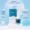 Serum trị mụn Lumos Acne 5ML
