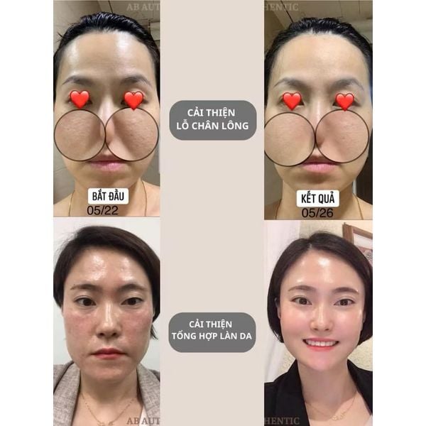 1 Vỉ 2ml Sample Peel da CNP rx Skin Rejuvenating Intensive Peel giúp làm căng bóng da, phục hồi lão hóa, mờ sạm nám