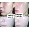 1 Vỉ 2ml Sample Peel da CNP rx Skin Rejuvenating Intensive Peel giúp làm căng bóng da, phục hồi lão hóa, mờ sạm nám