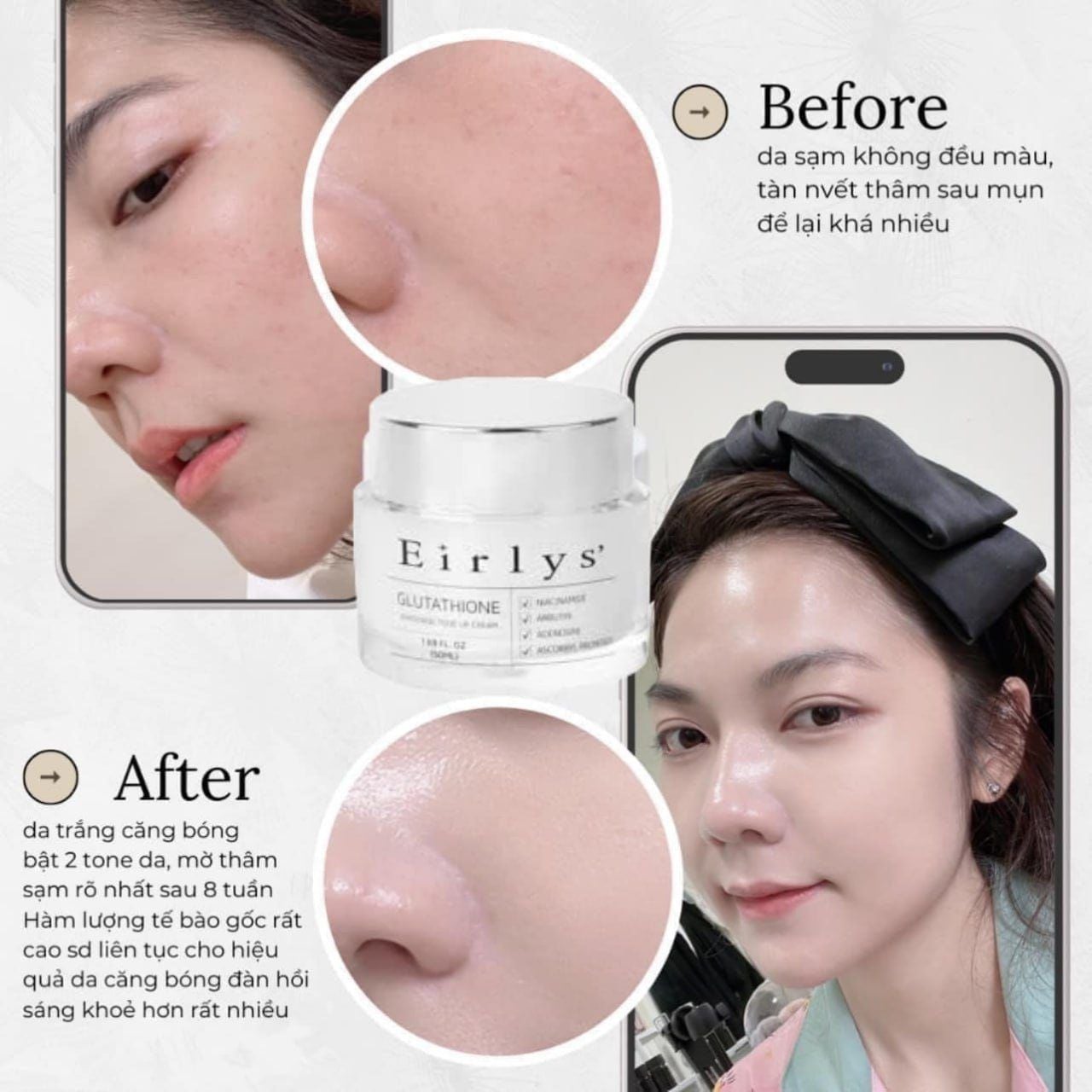 Kem dưỡng trị nám trắng da EIRLYS' Glutathione Whitening Tone Up Cream