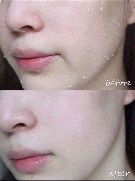Tẩy Da Chết Rau Má Prettyskin The Pure Jeju Cica Peeling Gel 150ml