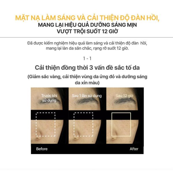 (CÔNG TY) Mặt Nạ Dạng Thạch MediAnswer Mask 37g (Mẫu Mới)
