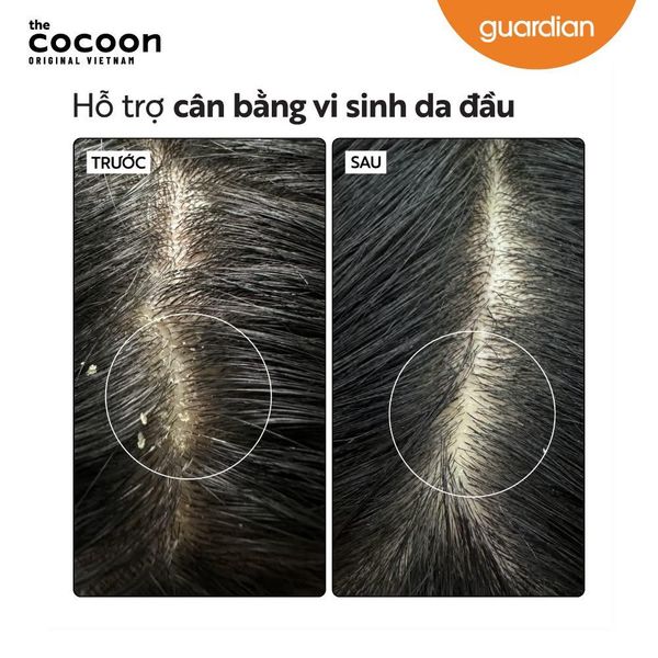 Nước Dưỡng Tóc Cocoon Bồ Kết Giảm Gàu Cho Da Đầu Nhạy Cảm 50ml/ 140ml