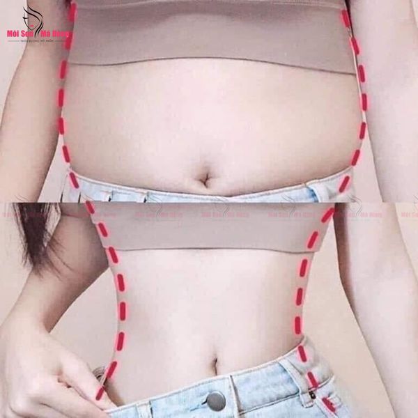 Gel Tan Mỡ Missha Săn Chắc Da, Tạo Dáng Thon Gọn 200ml Hot Burning Body Gel