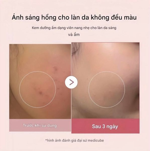 Kem dưỡng viên nang căng bóng da Medicube PDRN Pink Collagen Capsule Cream 55ml