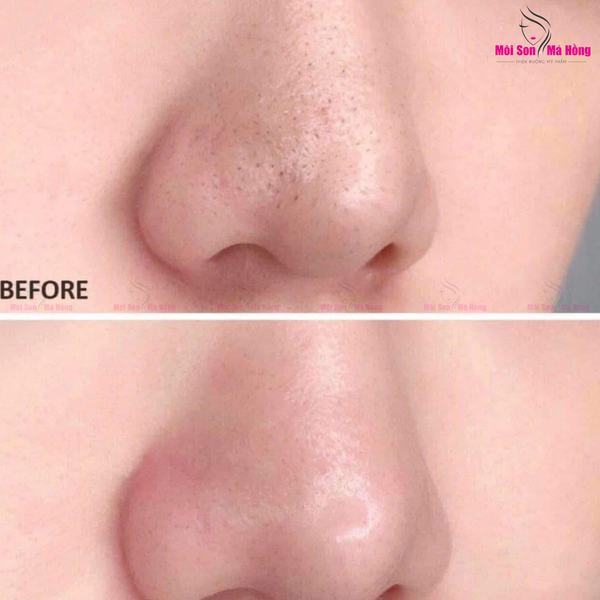 Gel Tẩy Tế Bào Chết Thế Hệ Mới CNP Laboaratory Invisible Peeling Booster Chứa PHA Giúp Cải Thiện Da Hàn Quốc 100ml