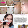 Kem Dưỡng Hỗ Trợ Giảm Nám Tàn Nhang MelasmaX 3D Whitening Clinic Renewal 40ml